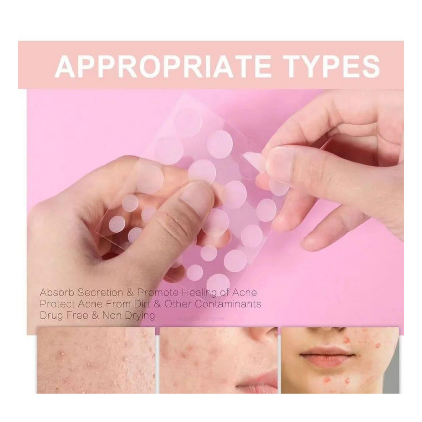 36 Pimple Patch – Clear Skin Acne Spot Treatment