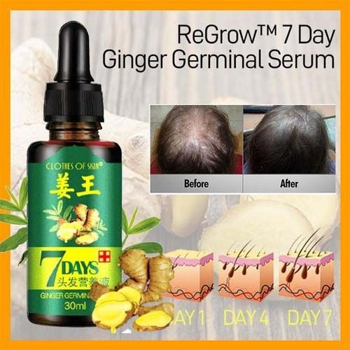 7 Day Ginger Hair Growth Oil – Natural Anti-Hair Loss